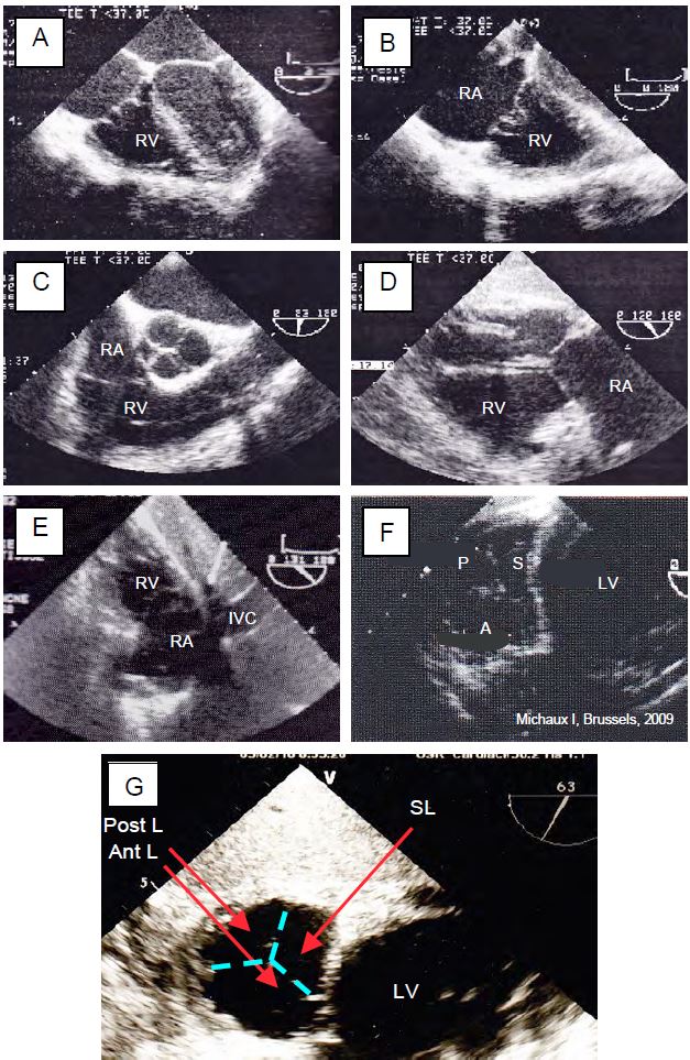 Fig26 46en