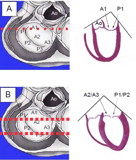 Fig26 5en