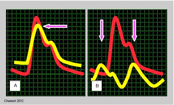 Fig6 21 en