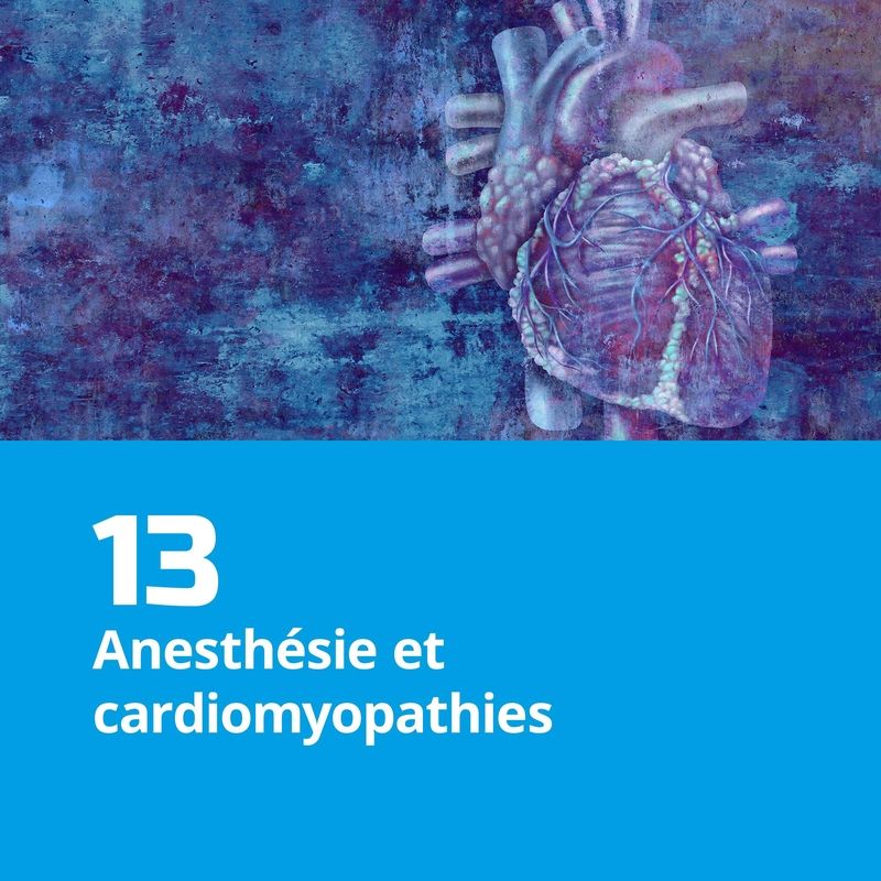 13. Anesthésie et cardiomyopathies