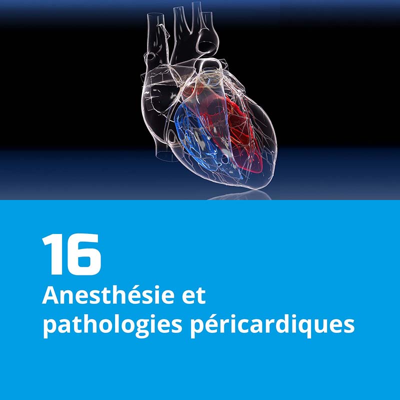 16. Anesthésie et pathologies péricardiques