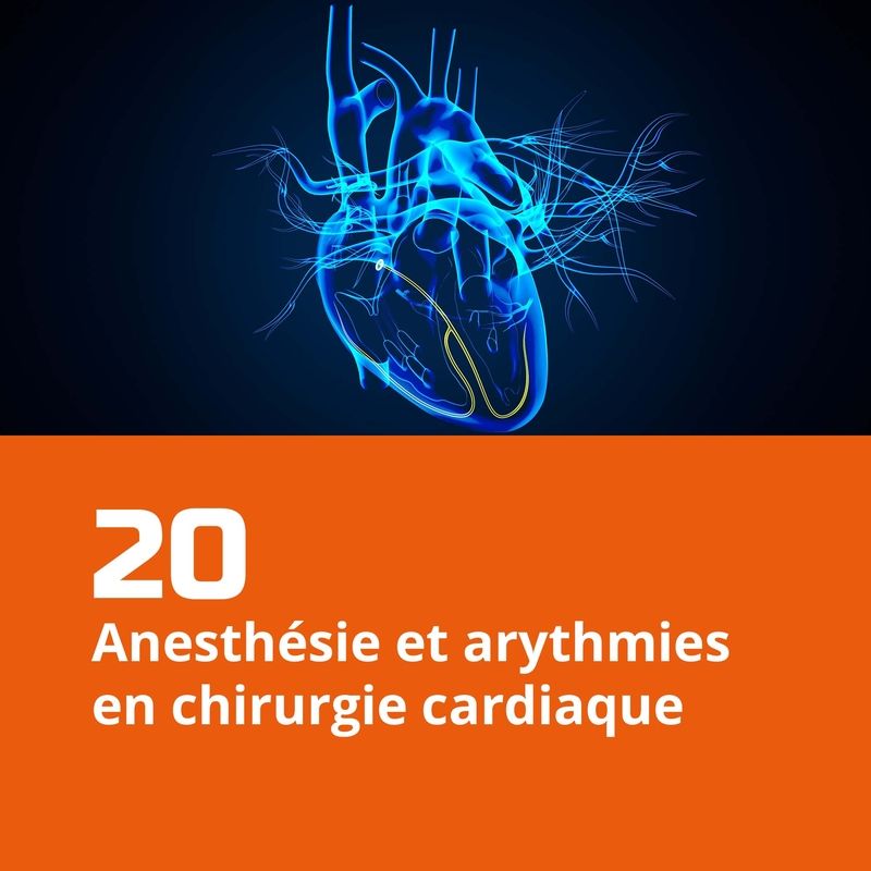 20. Anesthésie et arythmies en chirurgie cardiaque