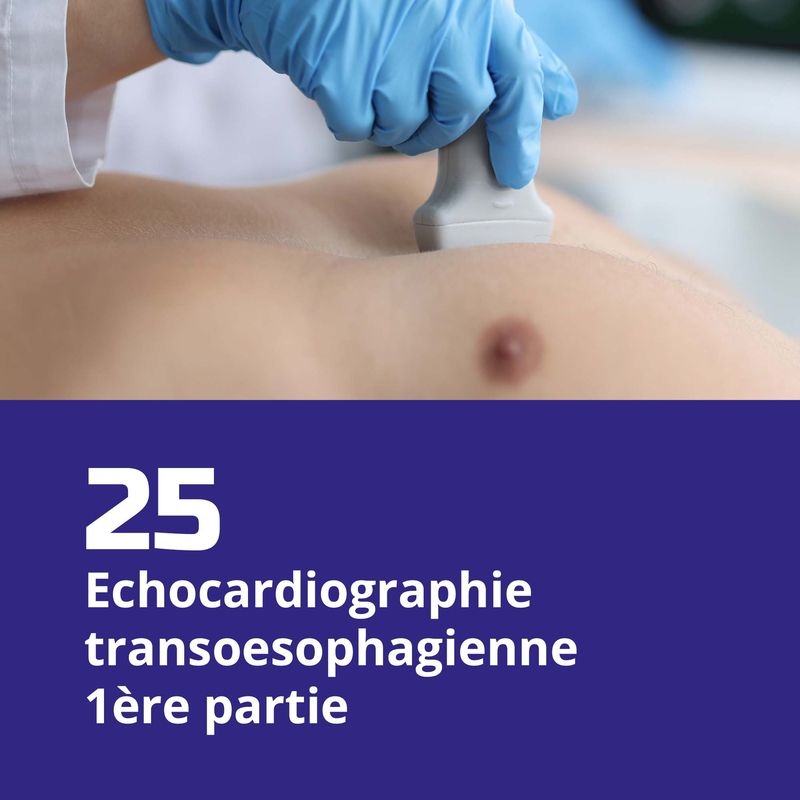 25. Echocardiographie transoesophagienne 1ère partie