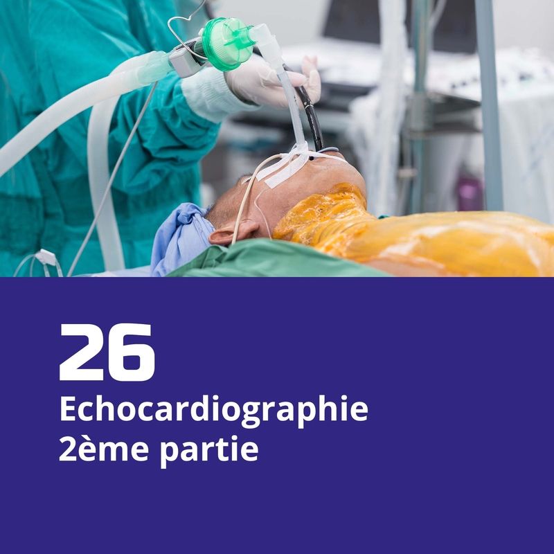 26. Echocardiographie, 2ème partie