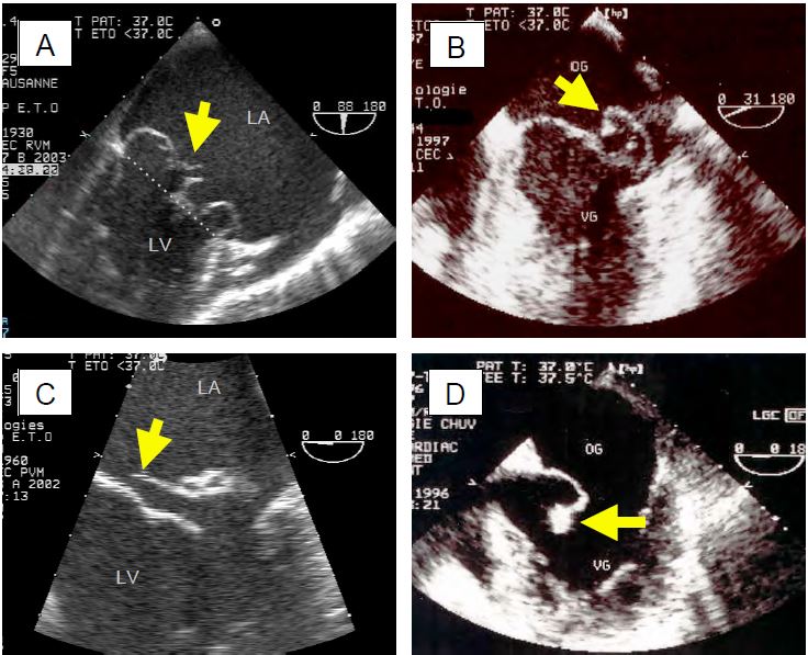 Fig11 64 en