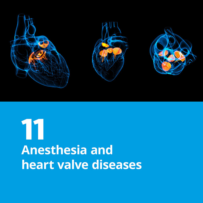 11. Anesthesia and heart valve diseases