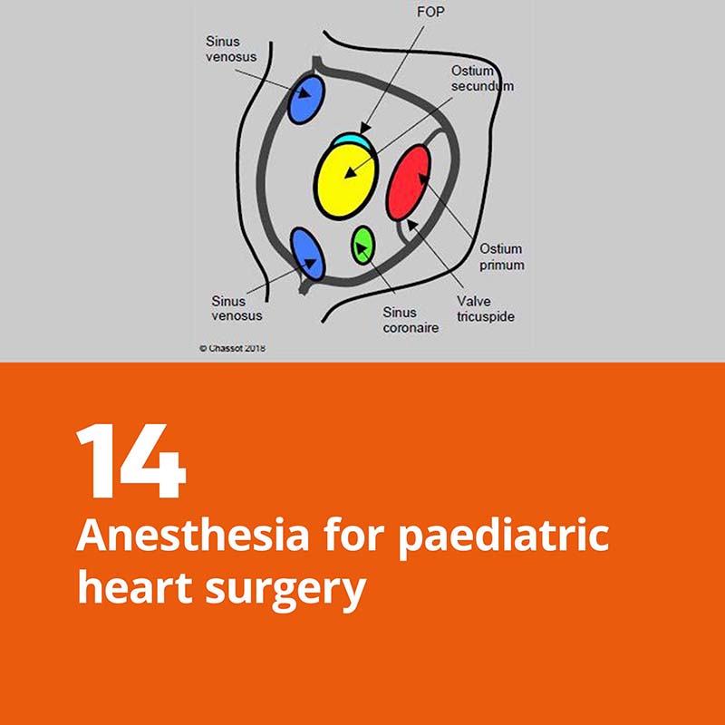 14. Anesthesia for paediatric heart surgery